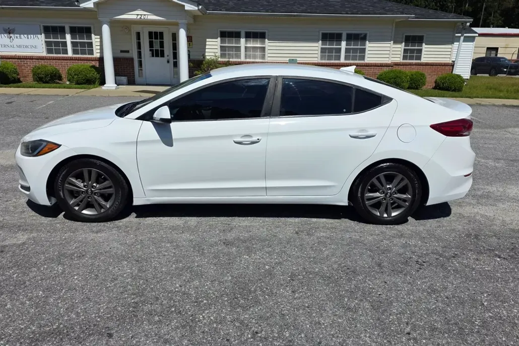 2017 Hyundai Elantra SE Tech Limited photo 1